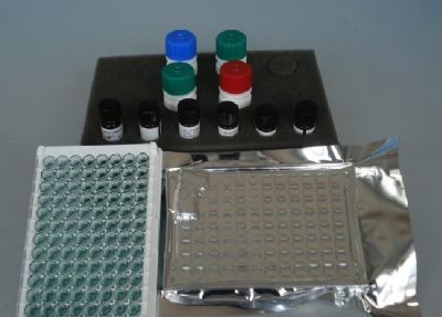 SM人鞘磷脂ELISA试剂盒 (货号:为您服务 )-上海博研生物工程研究中心